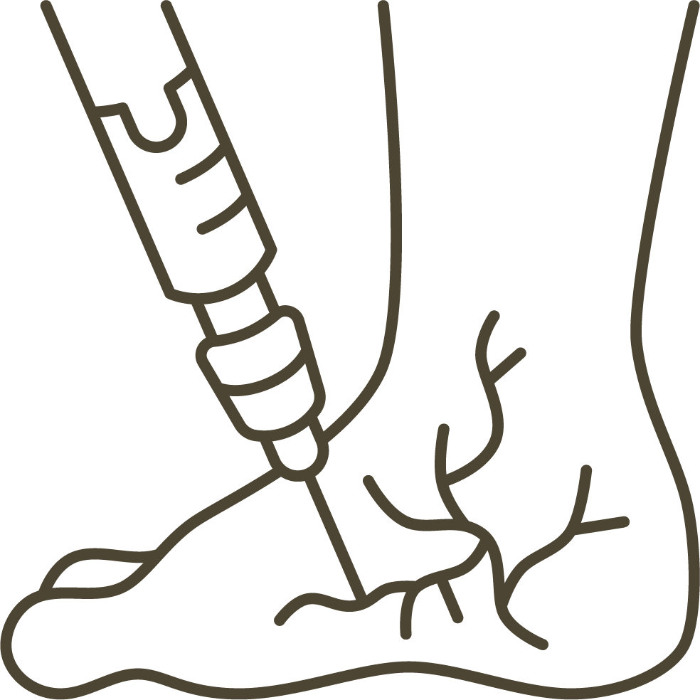 Spider Vein Treatment