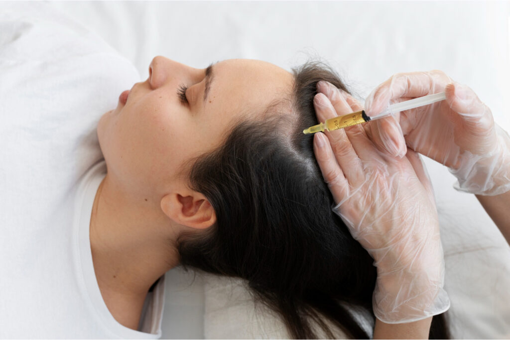 PRP Hair Restoration