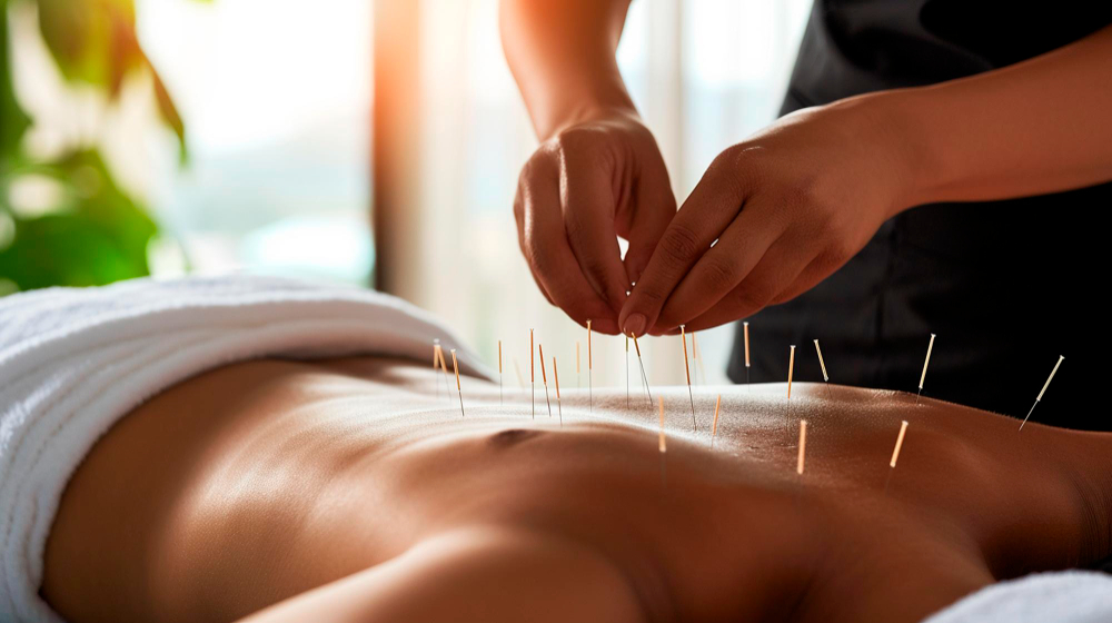 When Your Mind Won’t Switch Off: Can Acupuncture Help with Stress and Anxiety?